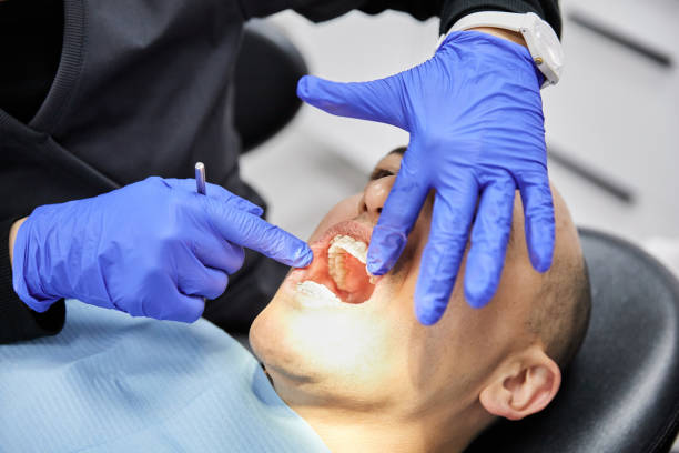 Best Emergency Broken Tooth Repair in Pecatonica, IL